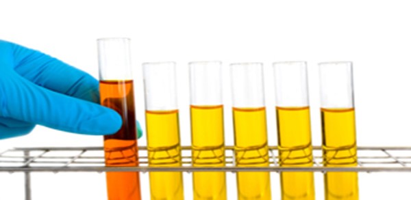 Synthetic Urine Novelty Kit Frazier Downs High Point NC